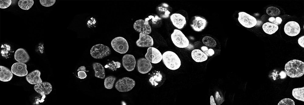 Yüksek çözünürlüklü mikroskop altında bakterilerin detaylı görüntüsü, bilimsel araştırmalar ve mikrobiyoloji çalışmaları için ideal. Bu görüntü, mikrobiyolojik analizler ve eğitim amaçlarıyla kullanıl.